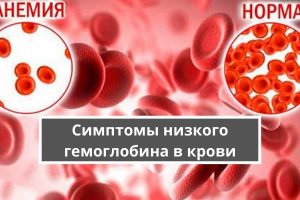 Симптомы низкого гемоглобина в крови