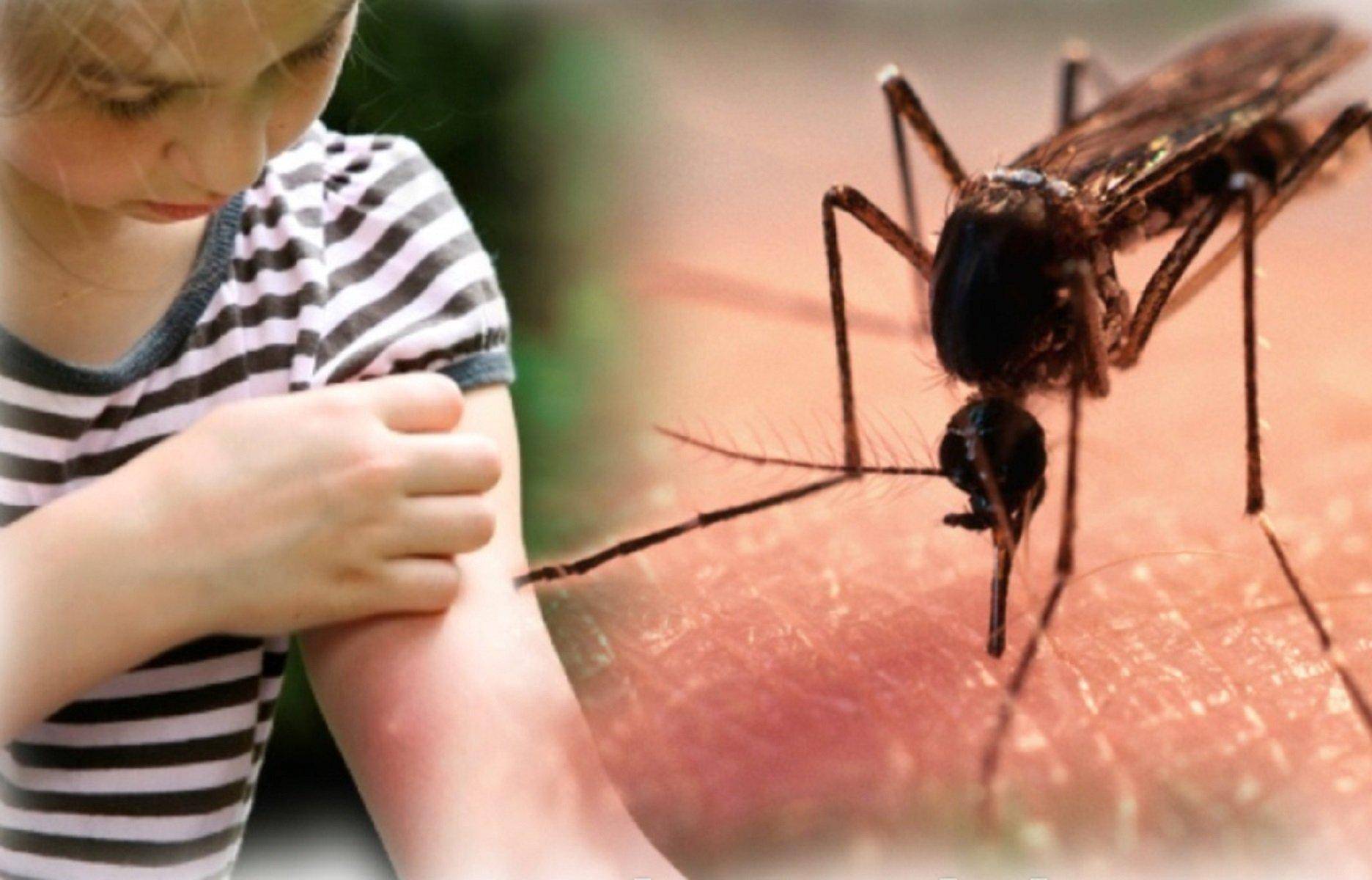 Что делать, если комариный укус зудит и чешется